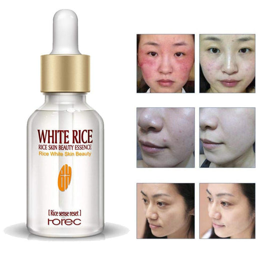 Rorec White Rice Serum for Face Whitening