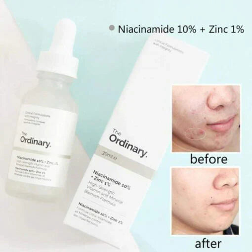 ORIGINAL NIACINAMIDE SERUM (WITH BATCH CODE)